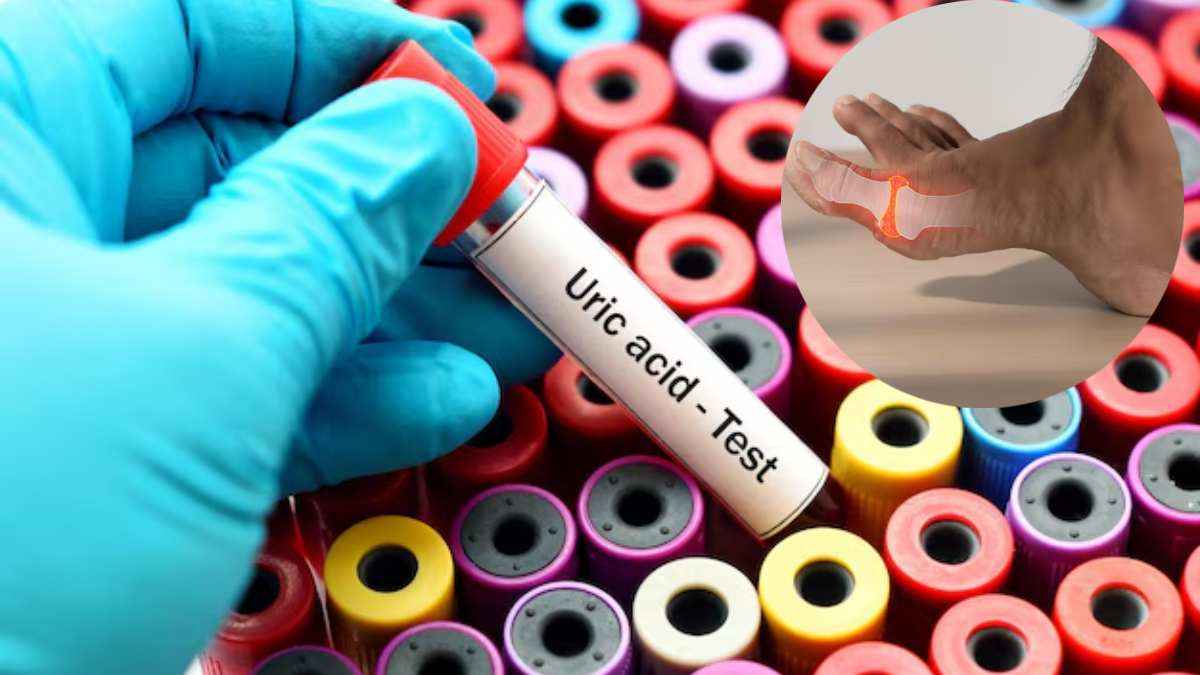 हाथ-पैर में दिखते हैं Uric Acid के ये 5 संकेत, नजरअंदाज करना पड़ सकता है भारी