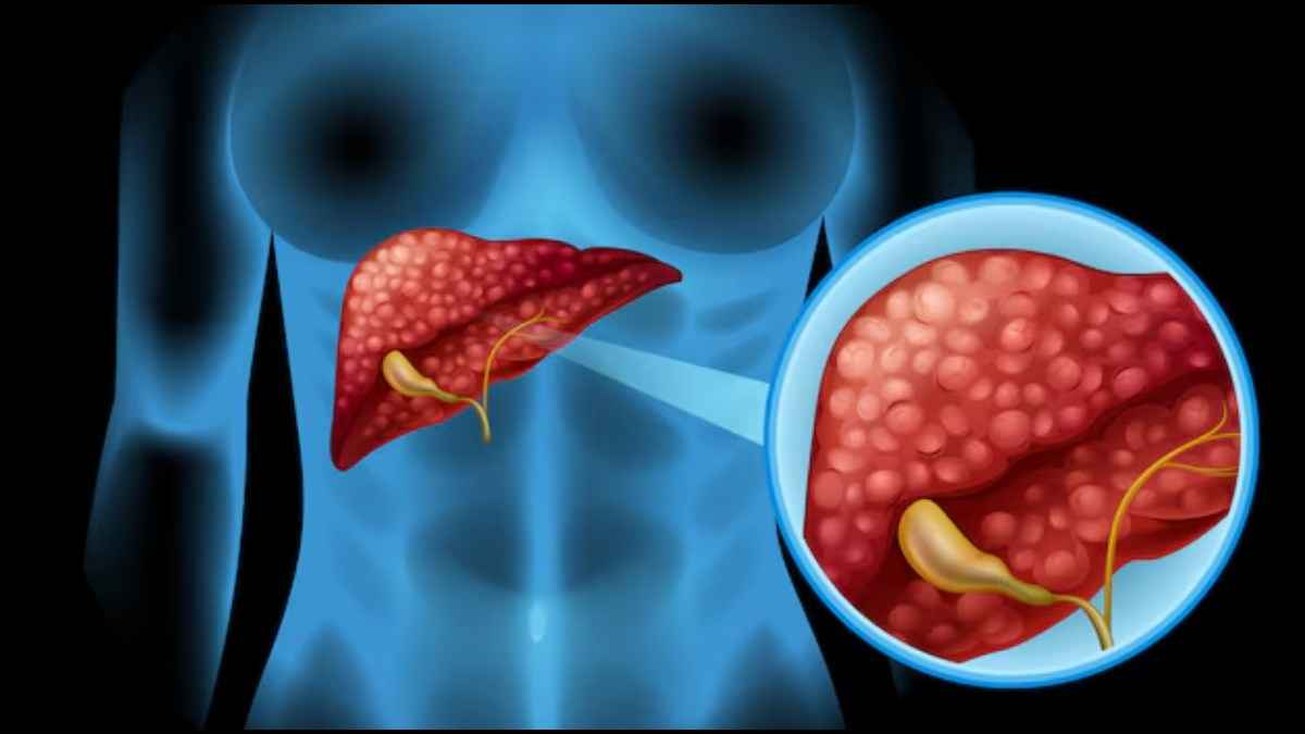 Liver Cancer के इन 6 संकेतों को न करें इग्नोर, डॉक्टर ने बताया बीमारी पहचानने का तरीका