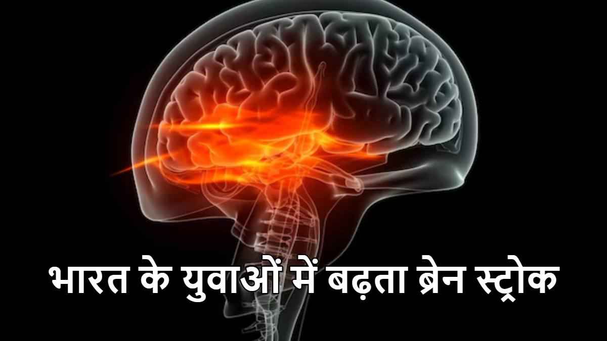 सावधान! भारत के युवाओं में बढ़ रहा है ब्रेन स्ट्रोक का खतरा, ISA का खुलासा