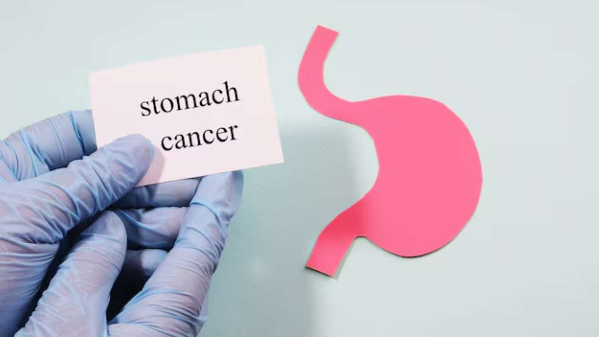 Stomach Cancer Symptoms