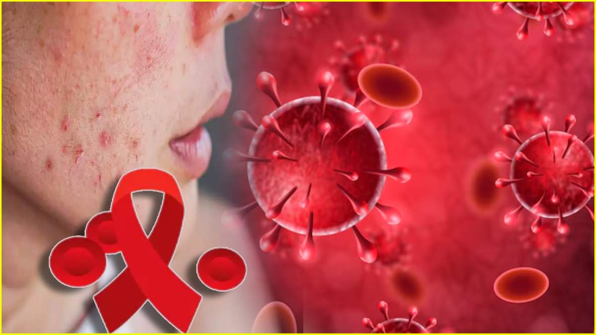 Blood Cancer Signs Blood Cancer Signs-1