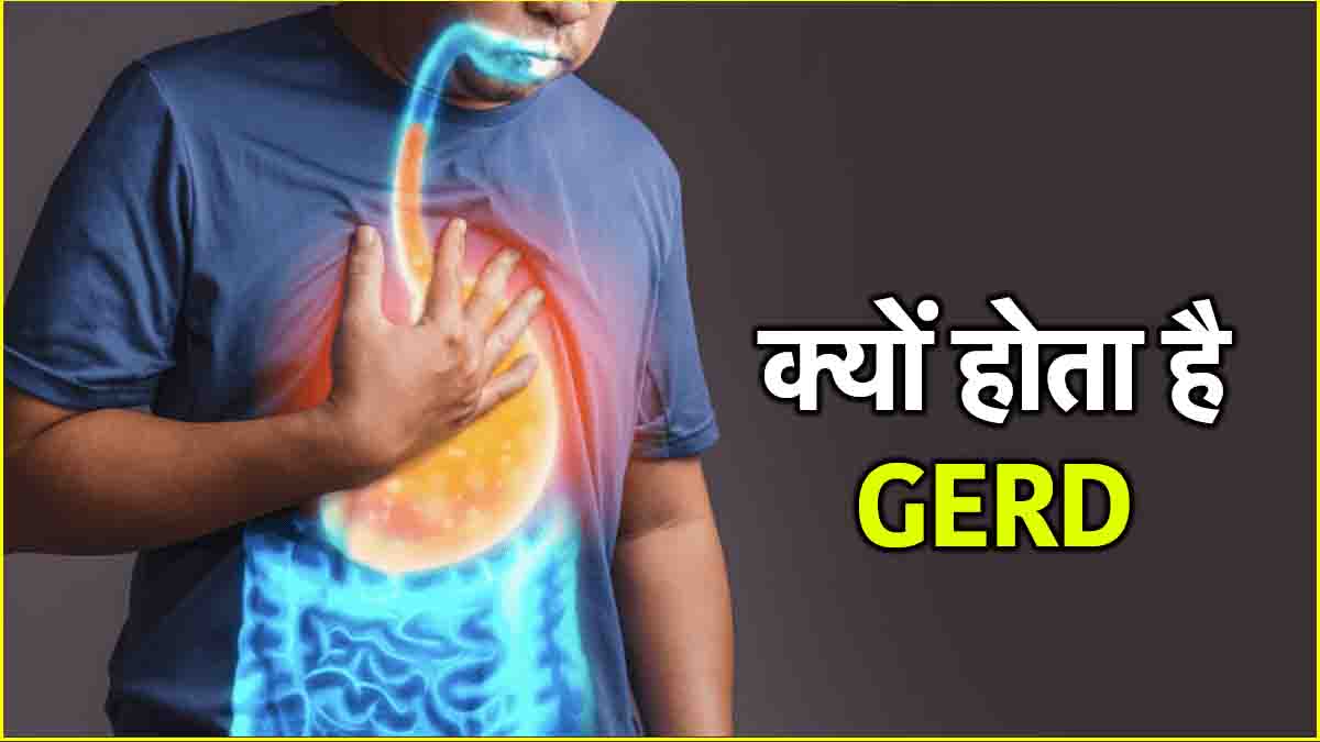 GERD Symptoms