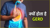 GERD Symptoms