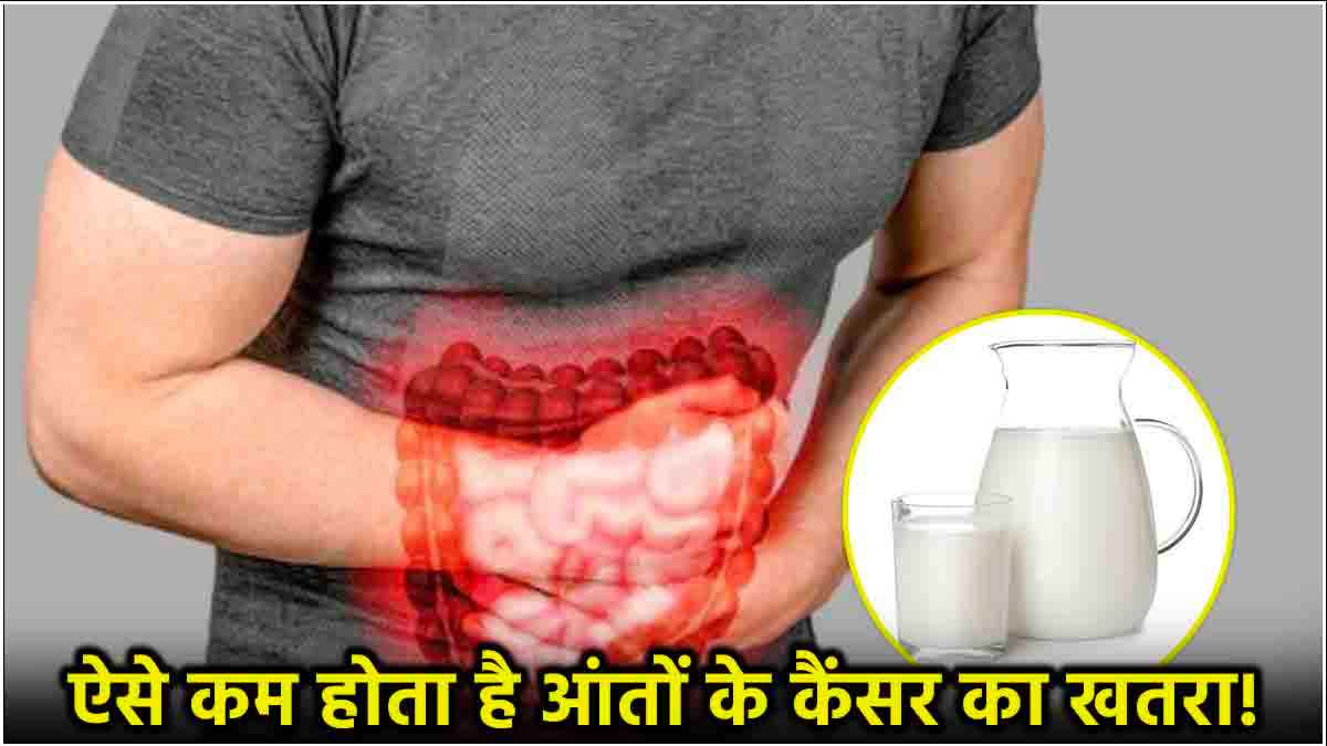 Colorectal Cancer: दूध पीने से आंतों के कैंसर का खतरा कम! रिसर्च में हुआ चौंका देने वाला खुलासा