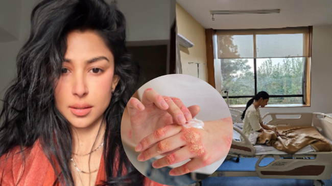 Actress Kapilakshi Malhotra Diagnosed With Myositis