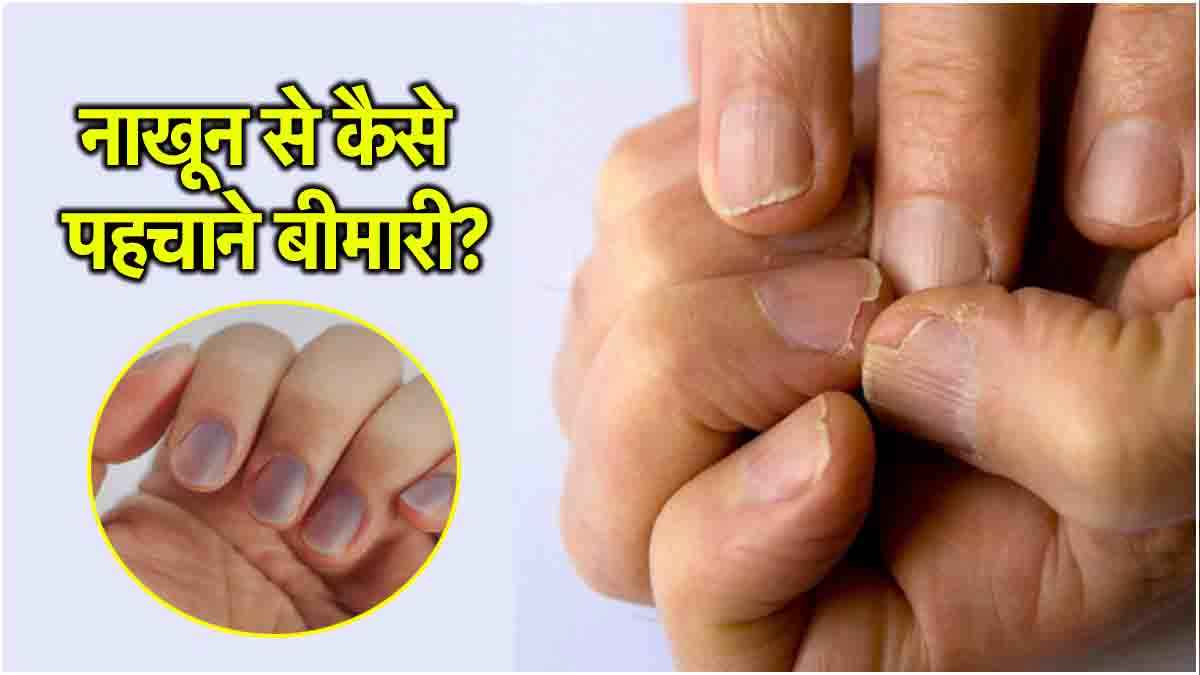 Health Tips: नाखून बताता है कैसी है आपकी हेल्थ? जानें कैसे करें बीमारी की पहचान