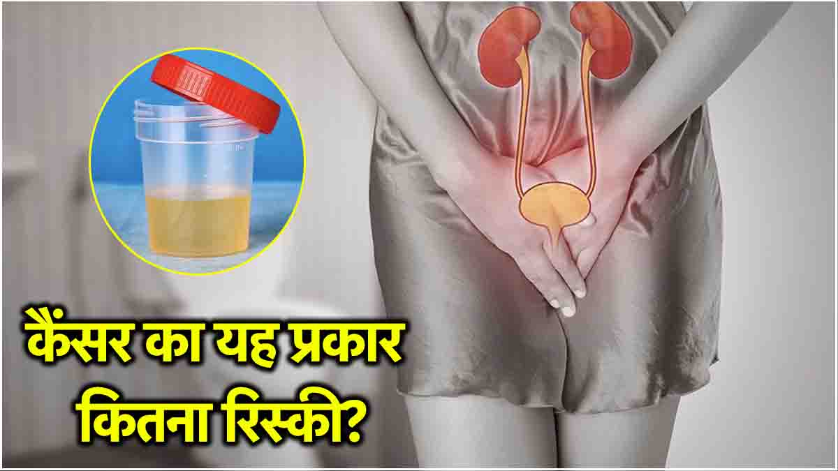 Urine Symptoms