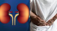 Kidney Failure Symptoms