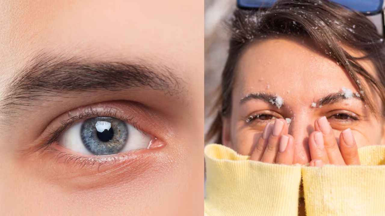 Health Tips: सर्दियों में आंखों में होती है जलन या चुभन? डॉक्टर ने बताए ये 3 टिप्स