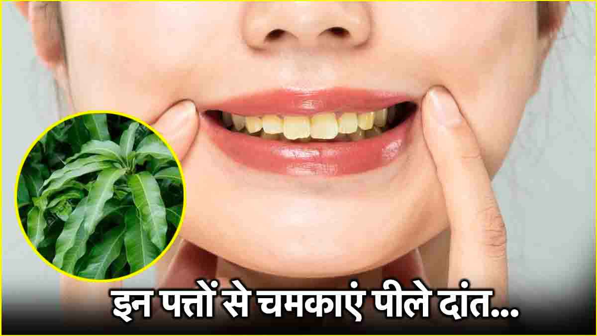 पीले दांतों को मिनटों में चमकाएंगे ये 3 उपाय! डेंटल एक्सपर्ट से जानें सही तरीका