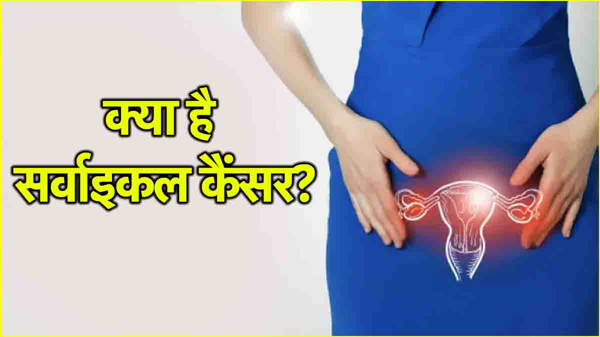 Cancer Cause: भारत में महिलाओं को इस कैंसर का रिस्क सबसे ज्यादा! ये हैं शरुआती संकेत और बचाव के तरीके..