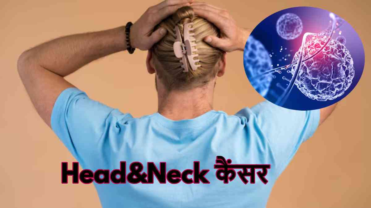 head and neck cancer