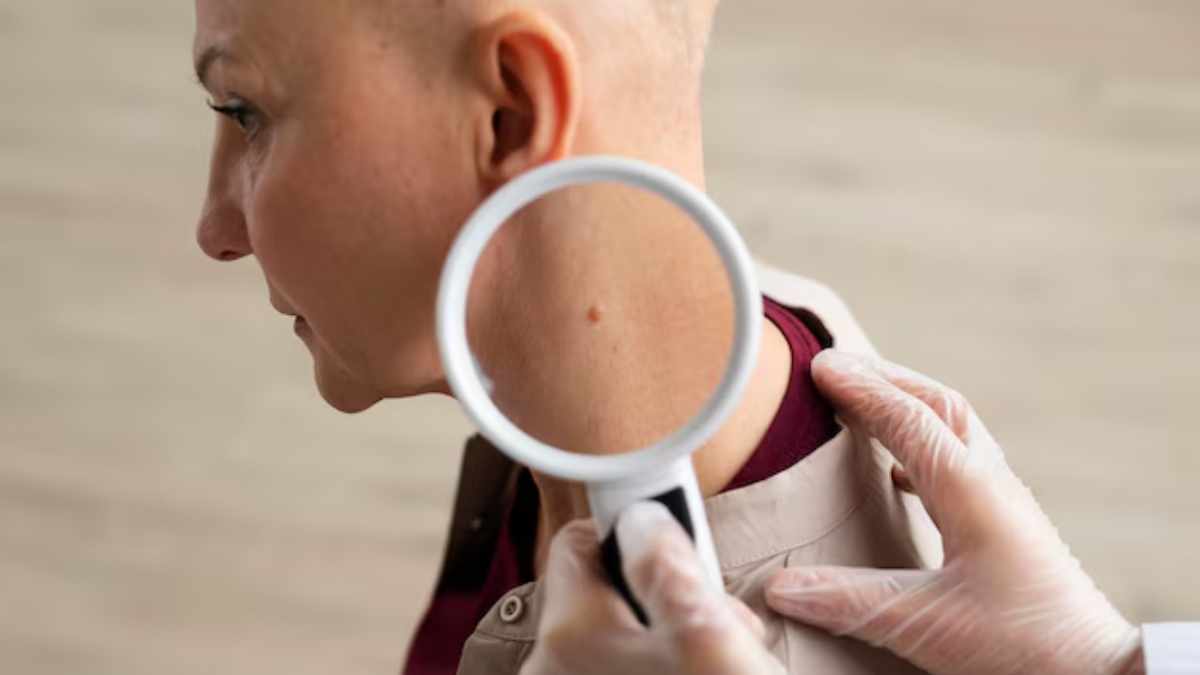 Blood Cancer Signs Blood Cancer Signs-1-2-3-4-5-6-7-8-9-10