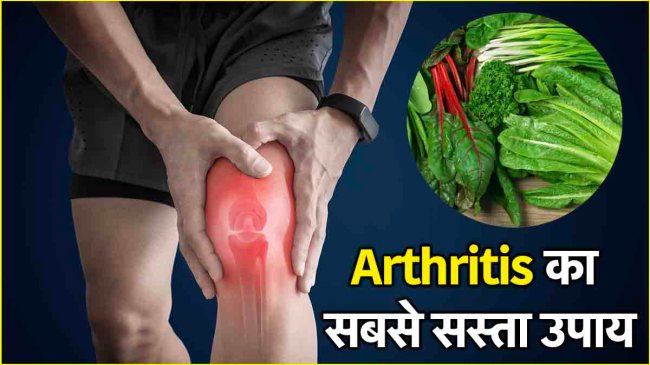 Arthritis Home Remedies Arthritis Home Remedies