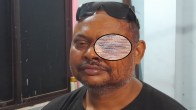 Businessman eye damaged in Howrah