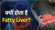 Fatty Liver Signs