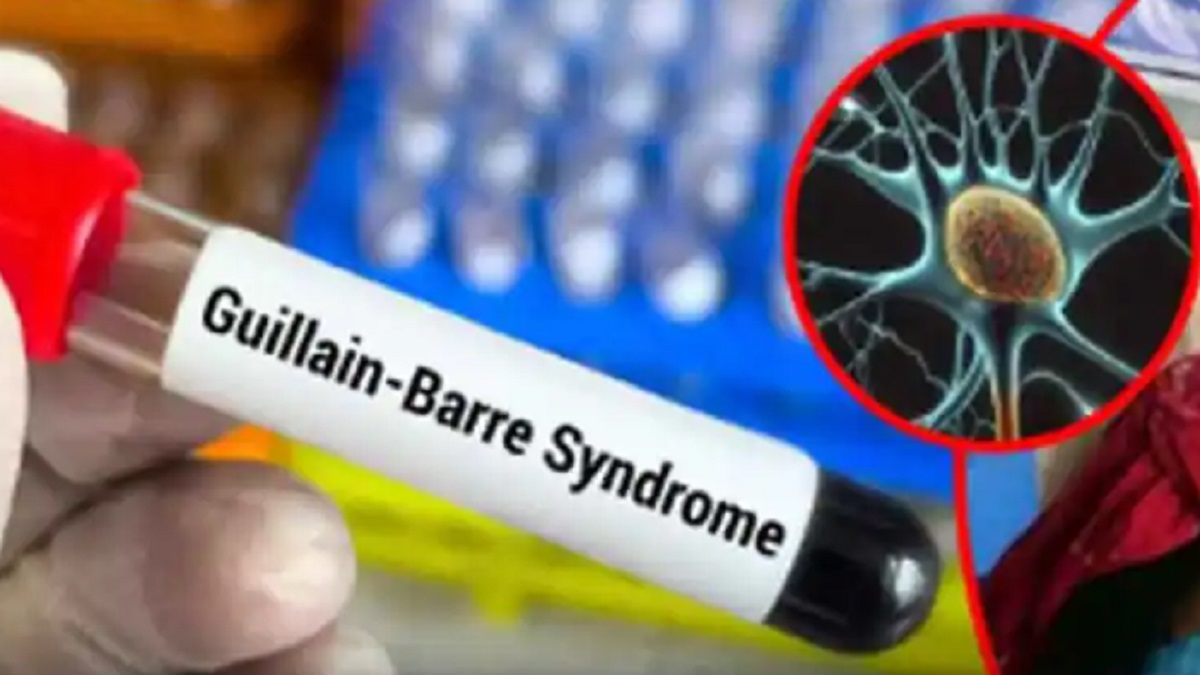 Guillain-Barre Syndrome Pune