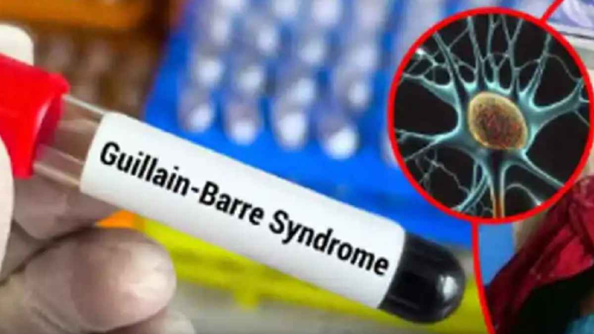 GB सिंड्रोम बीमारी का 'हॉटस्पॉट' बना पुणे, PMC कर रही इस बात की जांच