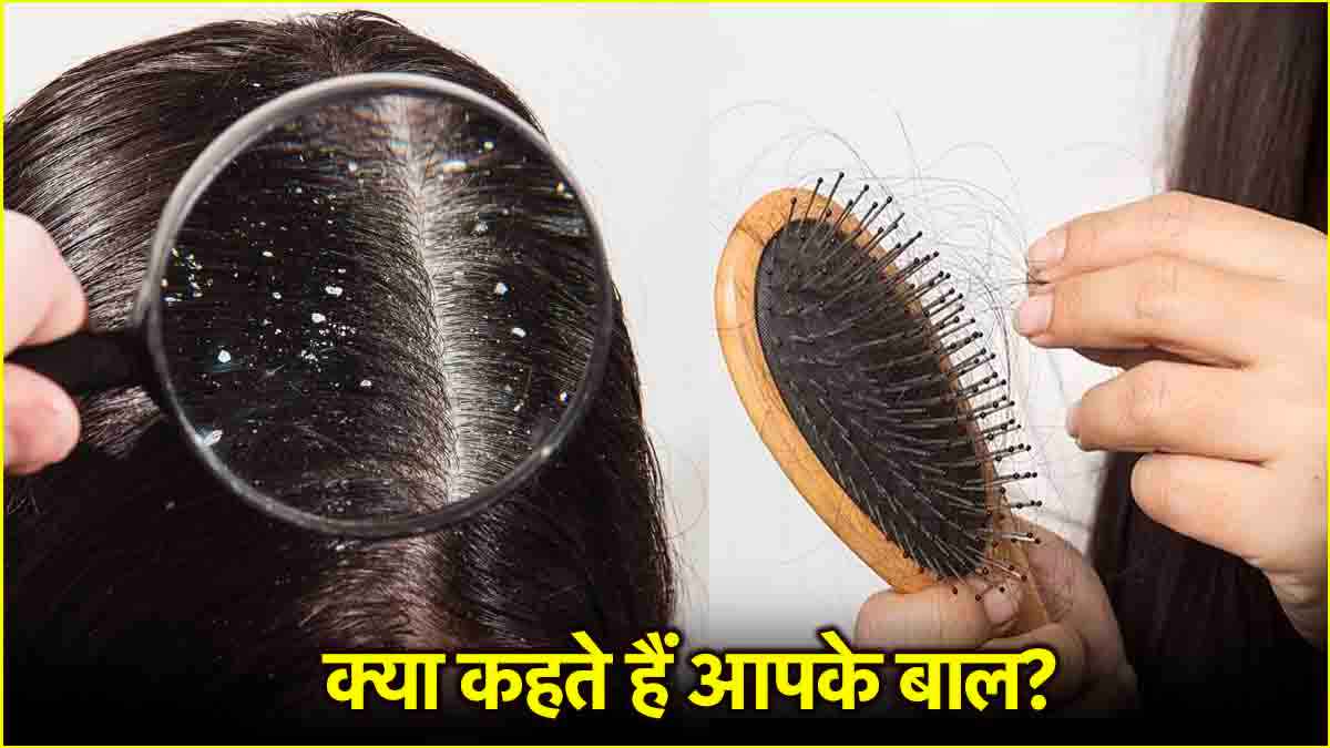 Hair Health Signs: बालों से पता लगाए आप हेल्दी है या नहीं, एक्सपर्ट से जानें संकेतों का सही मतलब