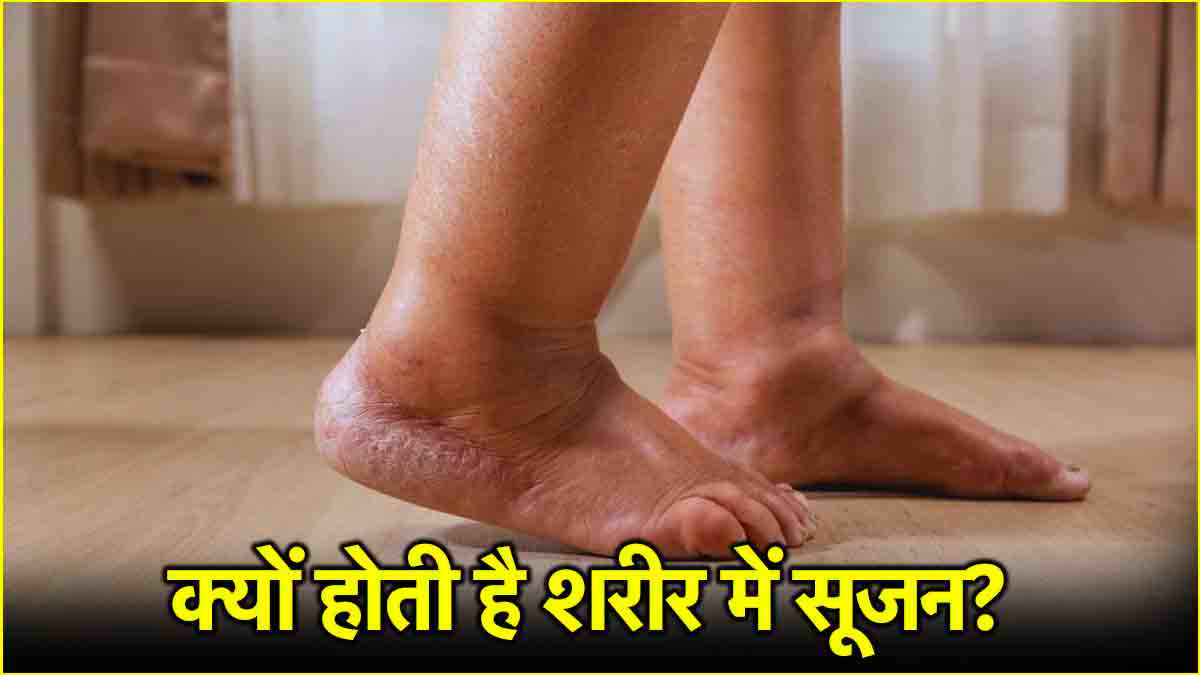 Health Tips: शरीर में सूजन और जोड़ों के दर्द को कैसे करें कंट्रोल? जानें हेल्थ एक्सपर्ट की राय