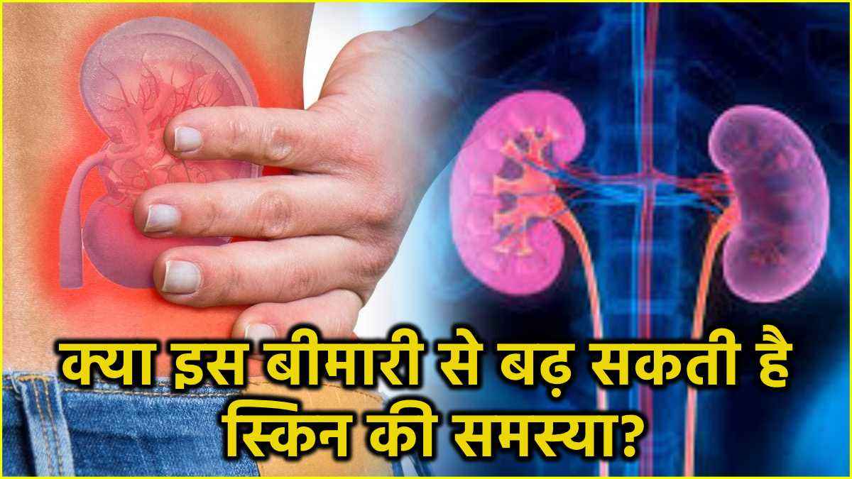 Kidney Failure: क्या किडनी फेलियर से बदल जाता है त्वचा का रंग? जानें एक्सपर्ट की राय