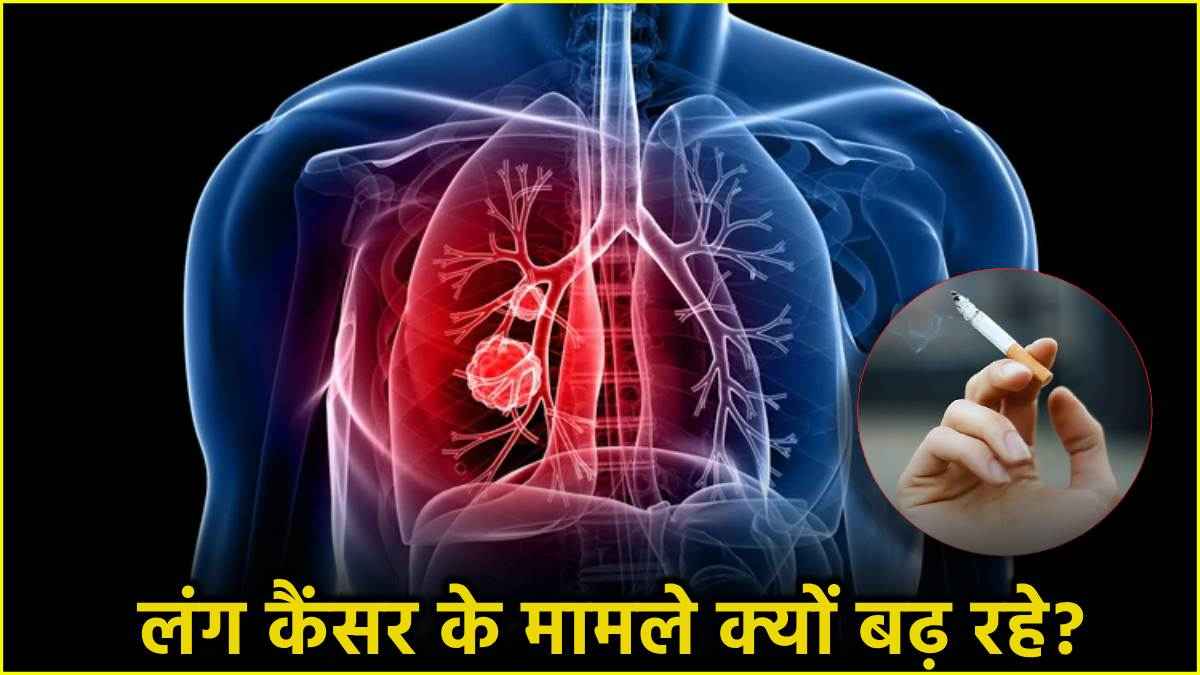 स्मोकिंग न करने वालों में क्यों बढ़ रहे हैं Lung Cancer के मामले? स्टडी में हुआ खुलासा