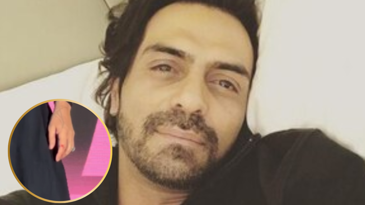 Arjun Rampal Injured