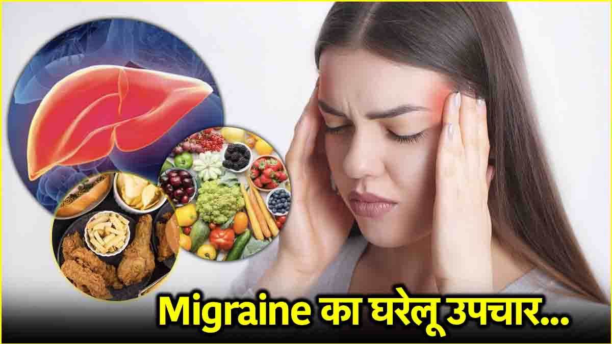 migraine causes