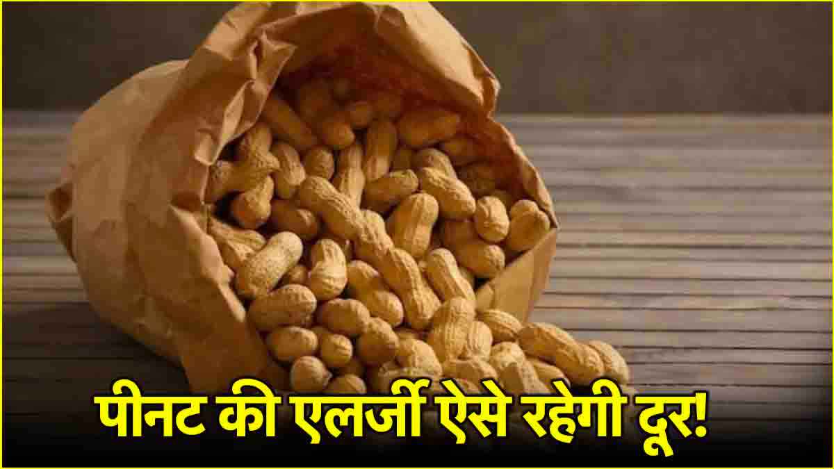 Peanut Allergies: क्या रोजाना पीनट बटर खाने से हो सकती है एलर्जी दूर? रिसर्च में आया सामने