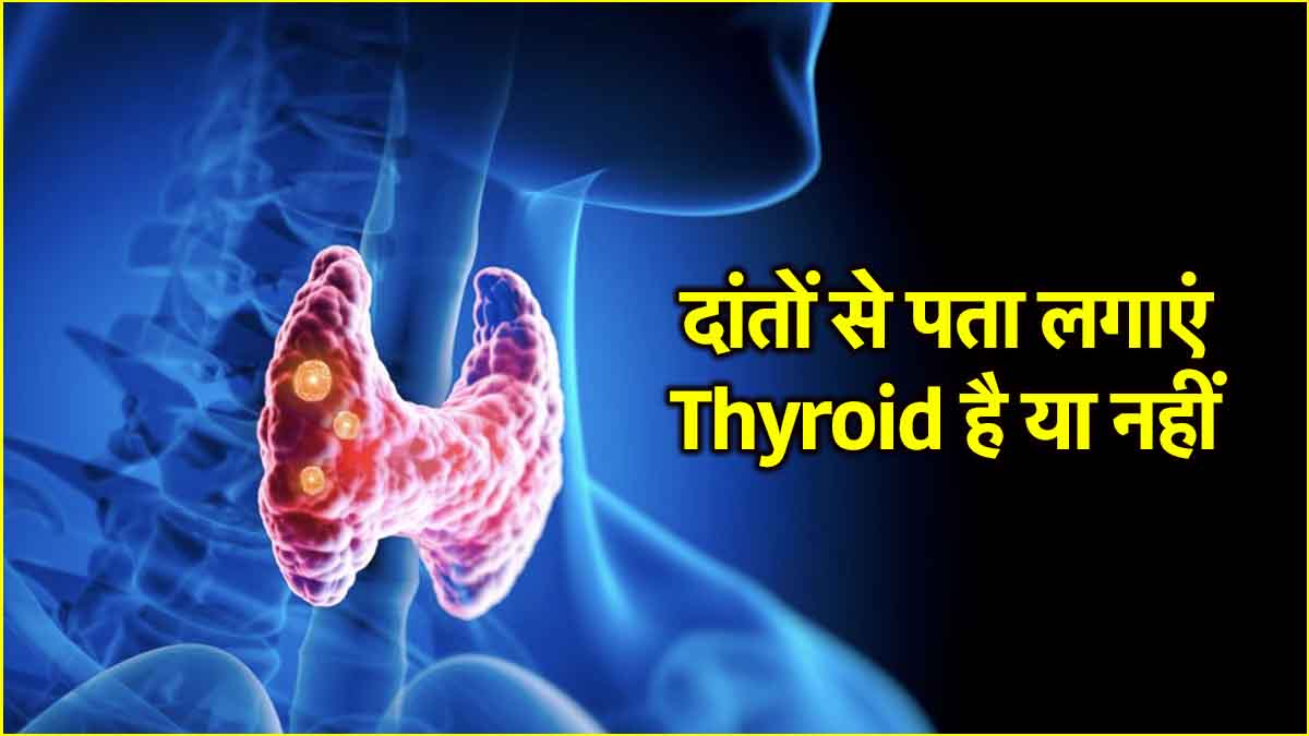 Thyroid Causes