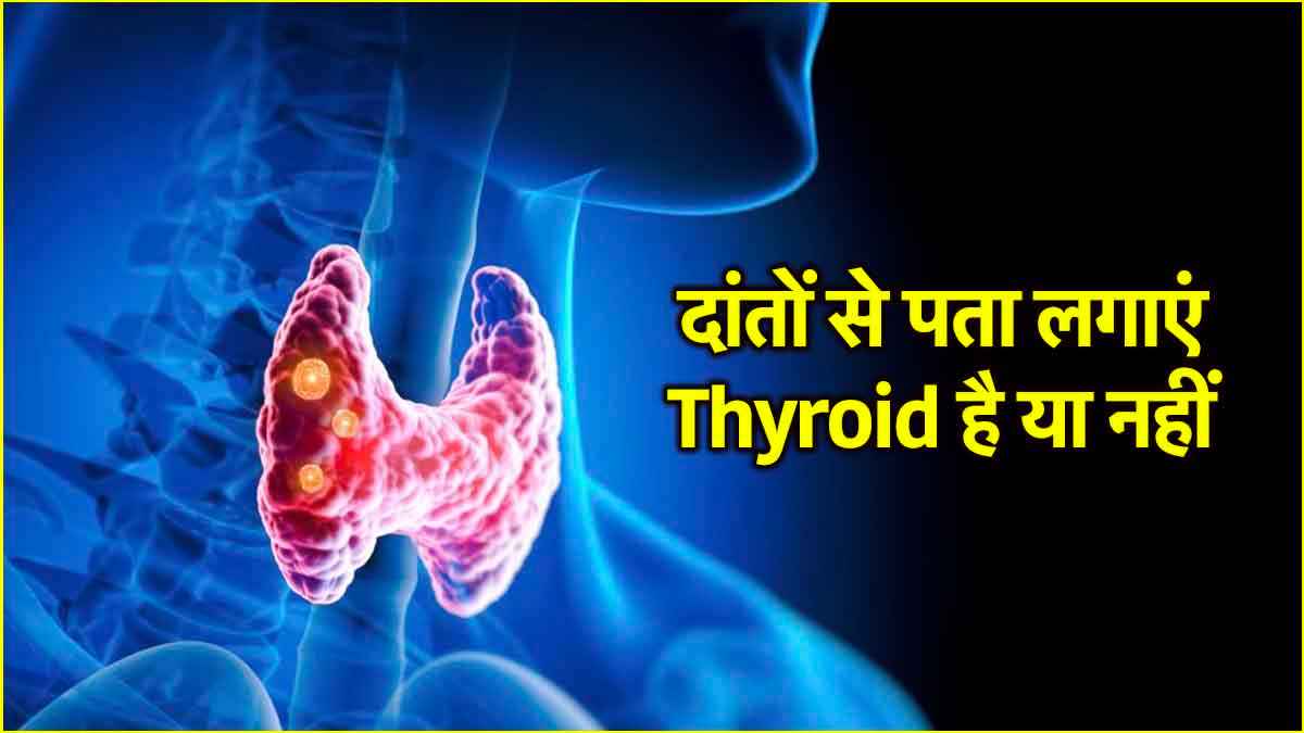 Thyroid Causes: दांतों की ये समस्याएं भी हैं थायराइड का एक संकेत, जानें डॉक्टर की एडवाइस