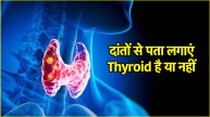 Thyroid Causes