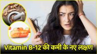 Vitamin B-12 Deficiency