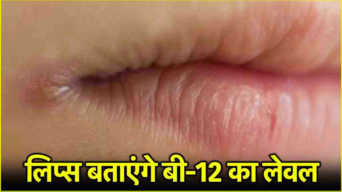Vitamin B12 Deficiency (1)