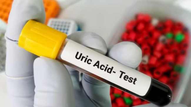 High Uric Acid Causes-1-2-3-4-5-6-7-8-9