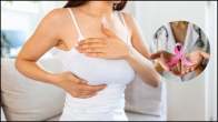 Breast Cancer Causes And Symptoms