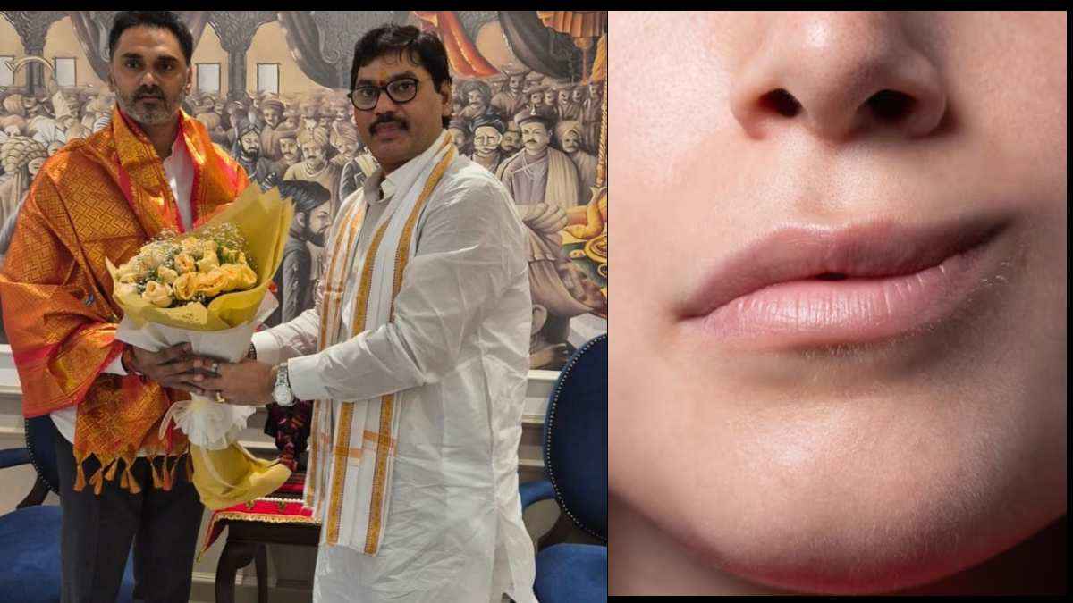 Bell's Palsy disease कितनी खतरनाक? महाराष्ट्र के मंत्री धनंजय मुंडे हुए शिकार, जानें बीमारी के संकेत क्या