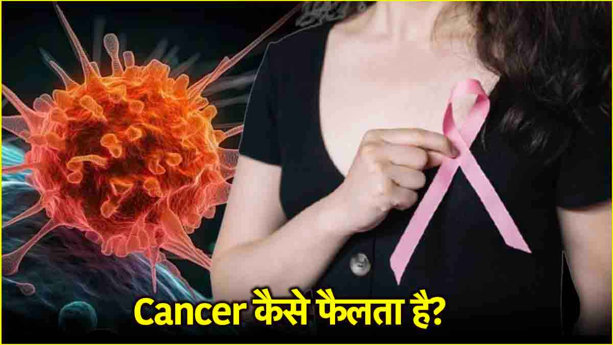 Cancer Causes