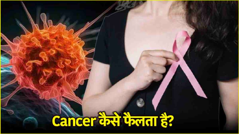 Cancer Causes