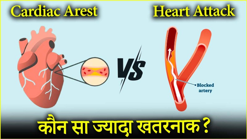 Cardiac and Heart Attack