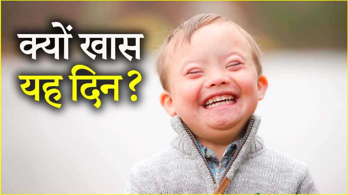 Down syndrome