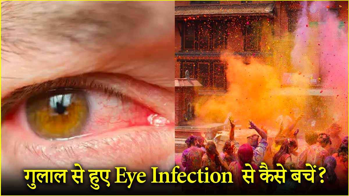 Holi 2025: होली के रंगों से आंखों में जलन को ऐसे दूर भगाएं, 5 टिप्स अपनाएं