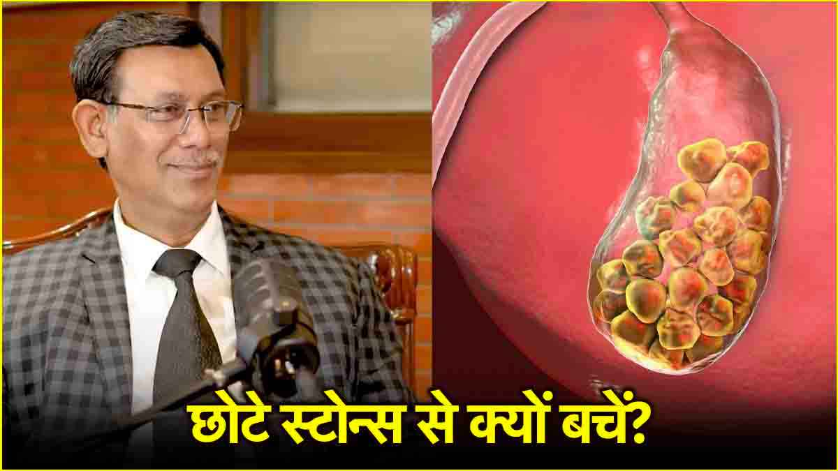 Stones Causes: ज्यादा खतरनाक है छोटी पथरी, एक्सपर्ट ने बताया क्यों?