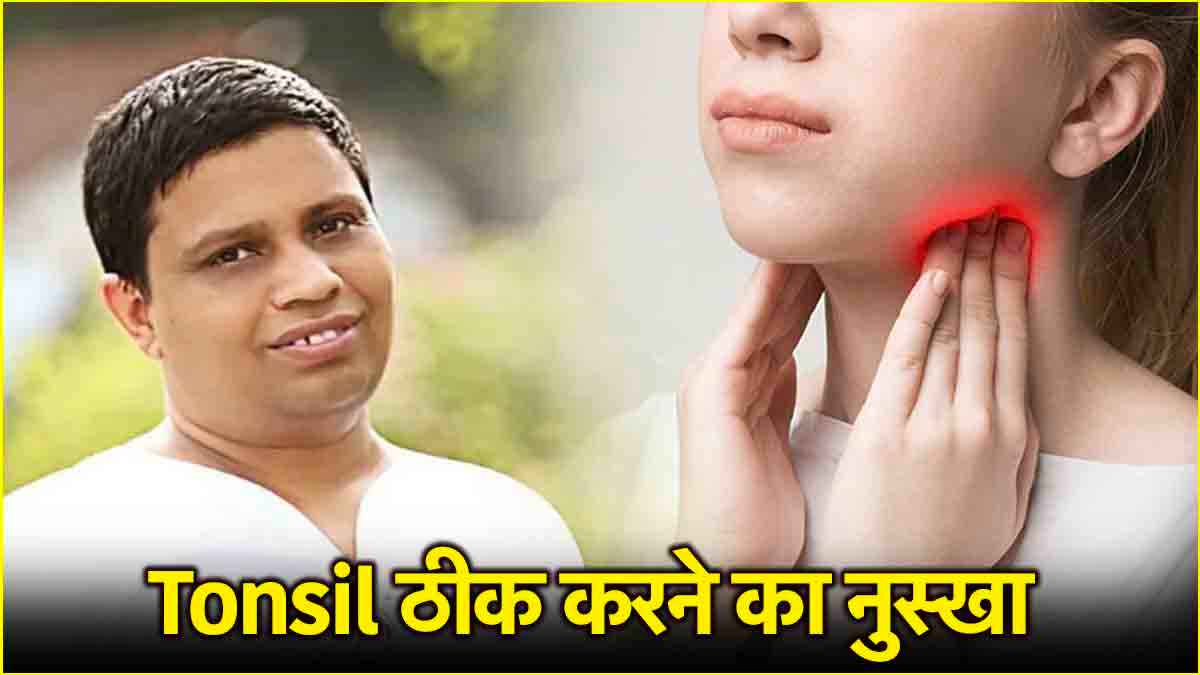 Acharya Balkrishna Health Tips: टॉन्सिल ठीक करने का जबरदस्त उपाय, पहली बार ट्राई करने से मिलेगी राहत