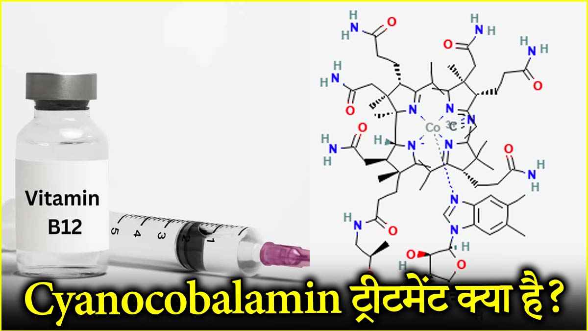 Vitamin B12 Deficiency