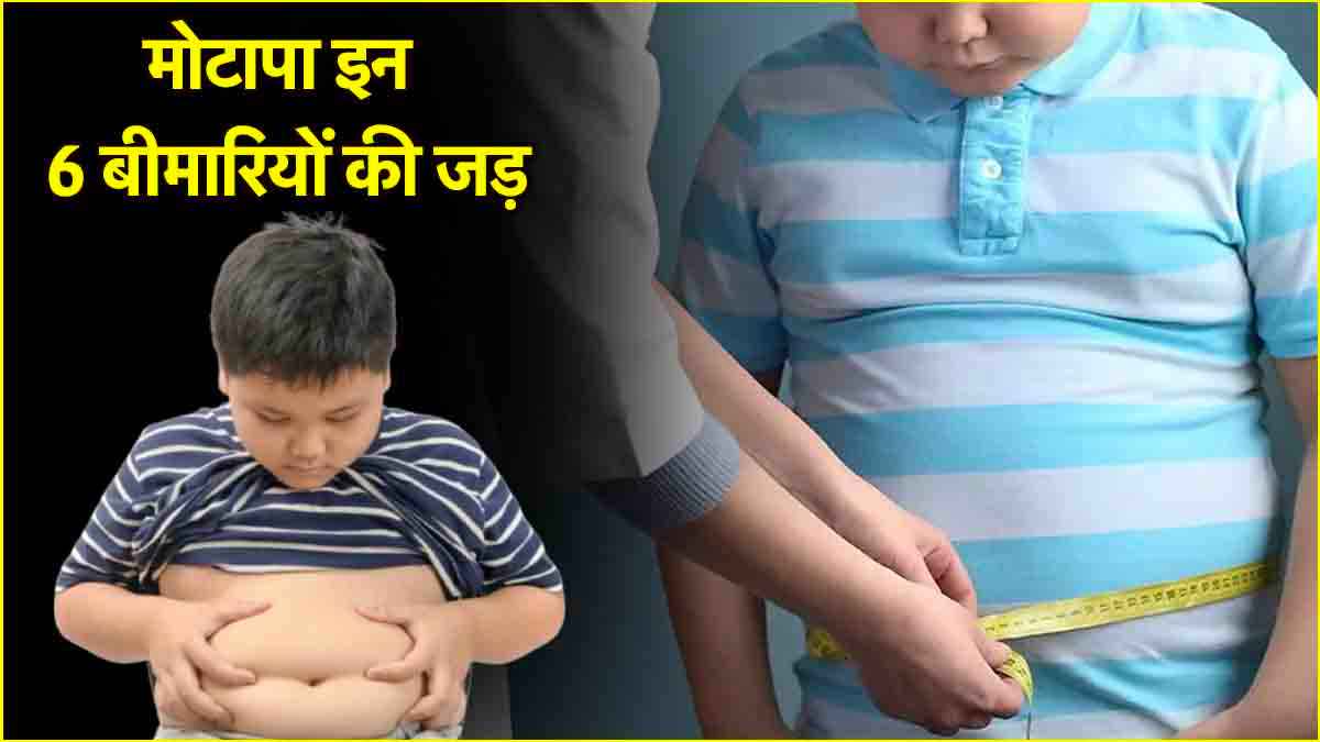 World Obesity Day
