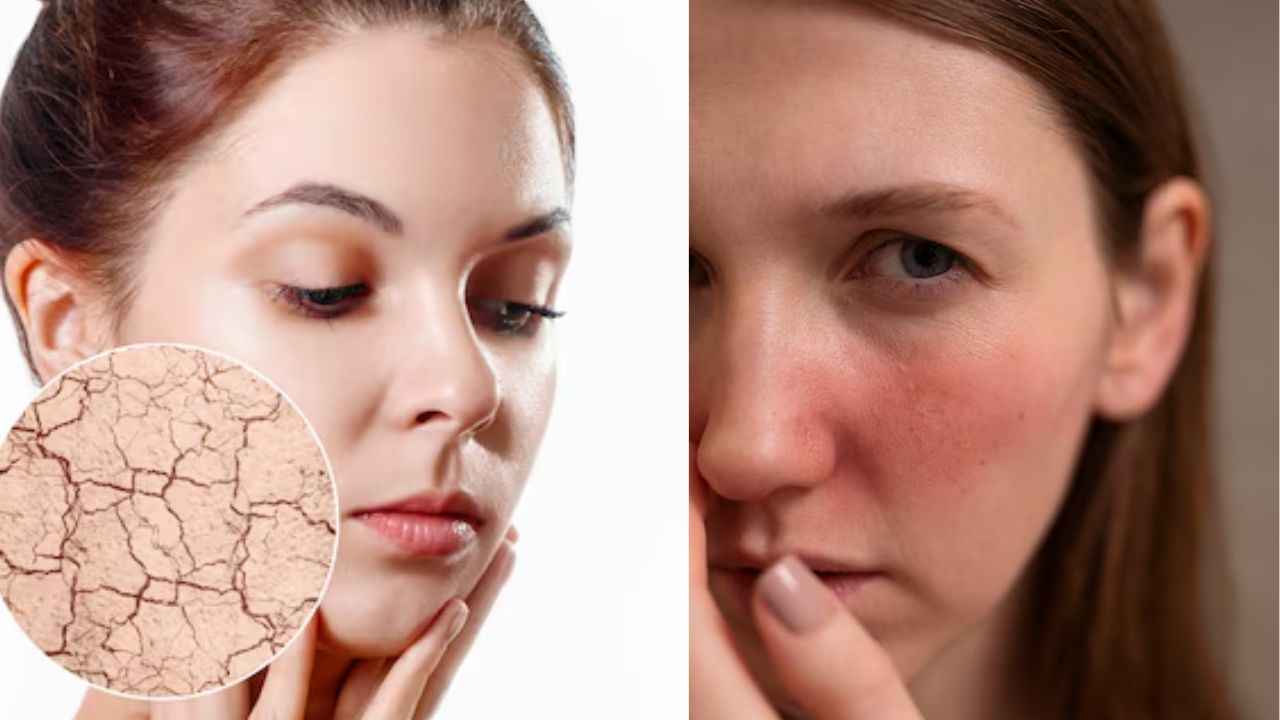 Skin Care Tips: कैसे पहचाने किस टाइप की है आपकी स्किन? अपनाएं ये आसान तरीके