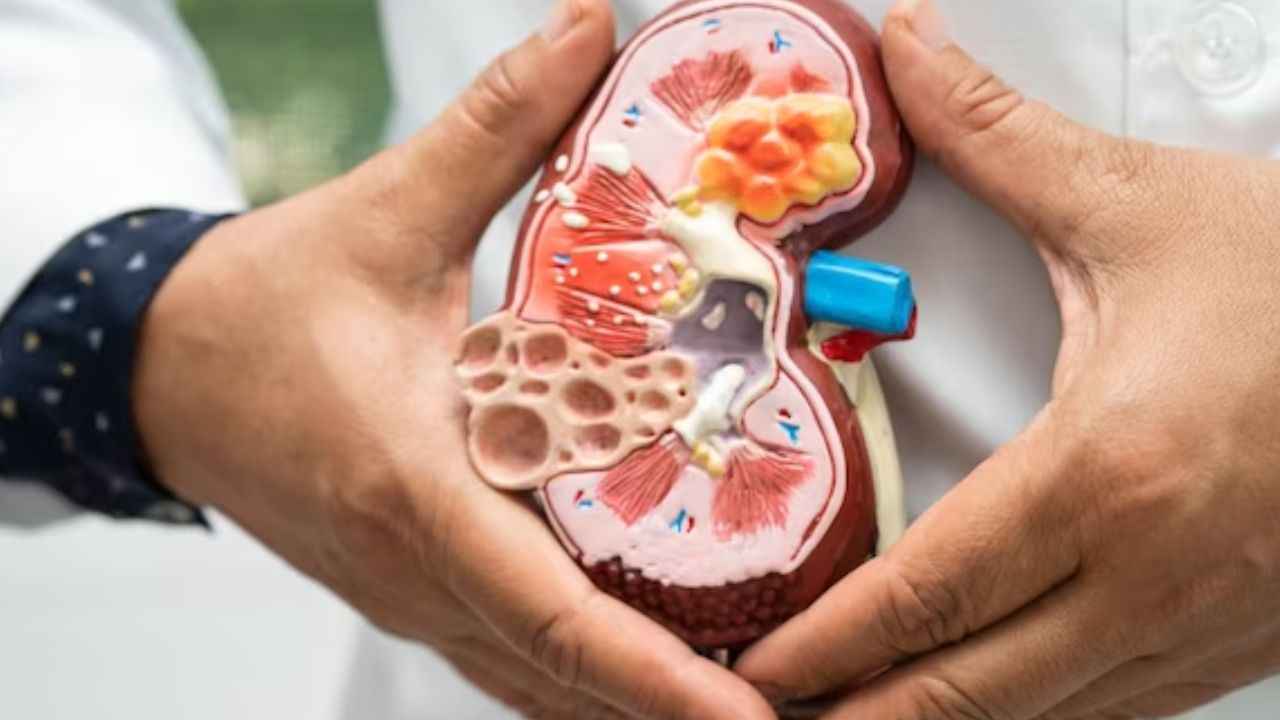 Chronic Kidney Disease से कैसे करें बचाव? जानें एक्सपर्ट की राय