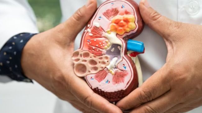 Chronic Kidney Disease