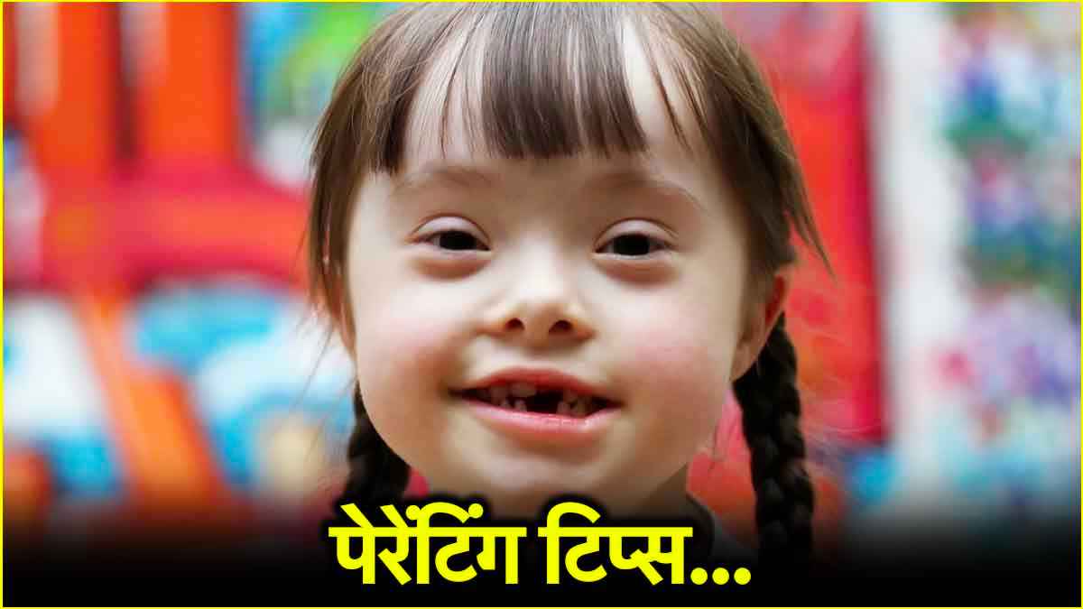 Down Syndrome से पीड़ित बच्चों में कैसे बढ़ाएं सोशल स्किल? डॉक्टर से जानें टिप्स